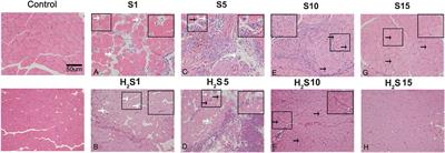 Hydrogen Sulfide Alleviates Skeletal Muscle Fibrosis via Attenuating Inflammation and Oxidative Stress